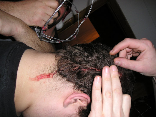 Dave Bleeds from his Crown