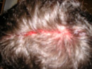 Dave Bleeding